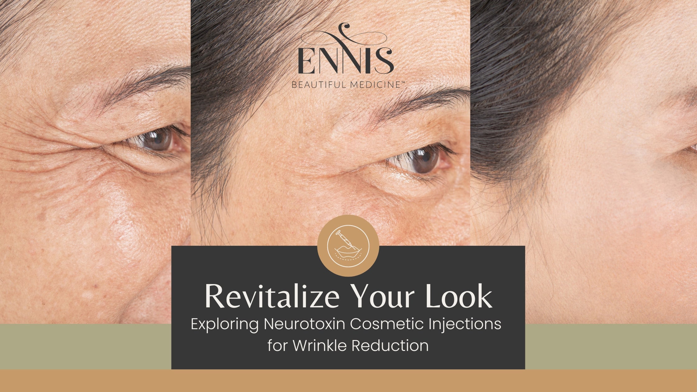 Neurotoxins for Smooth Skin Reduced Wrinkles by Dr. Ennis